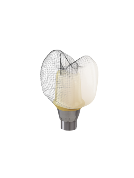 Atlantis CustomBase solution, Full-contour