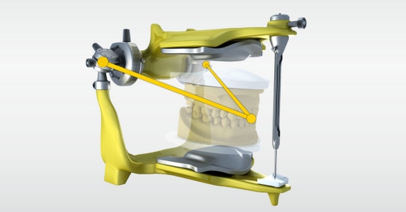 Articulation CEREC SW 5.2